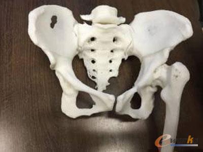 D打印髋关节进入量产时代_业界动态_信息化