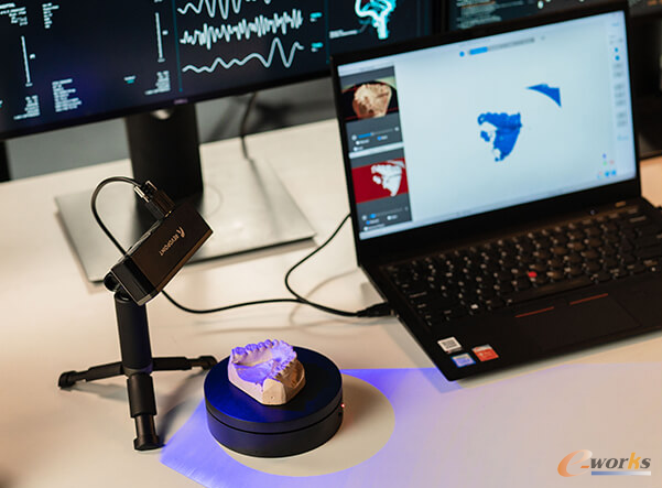 3D扫描仪应用于牙齿矫正